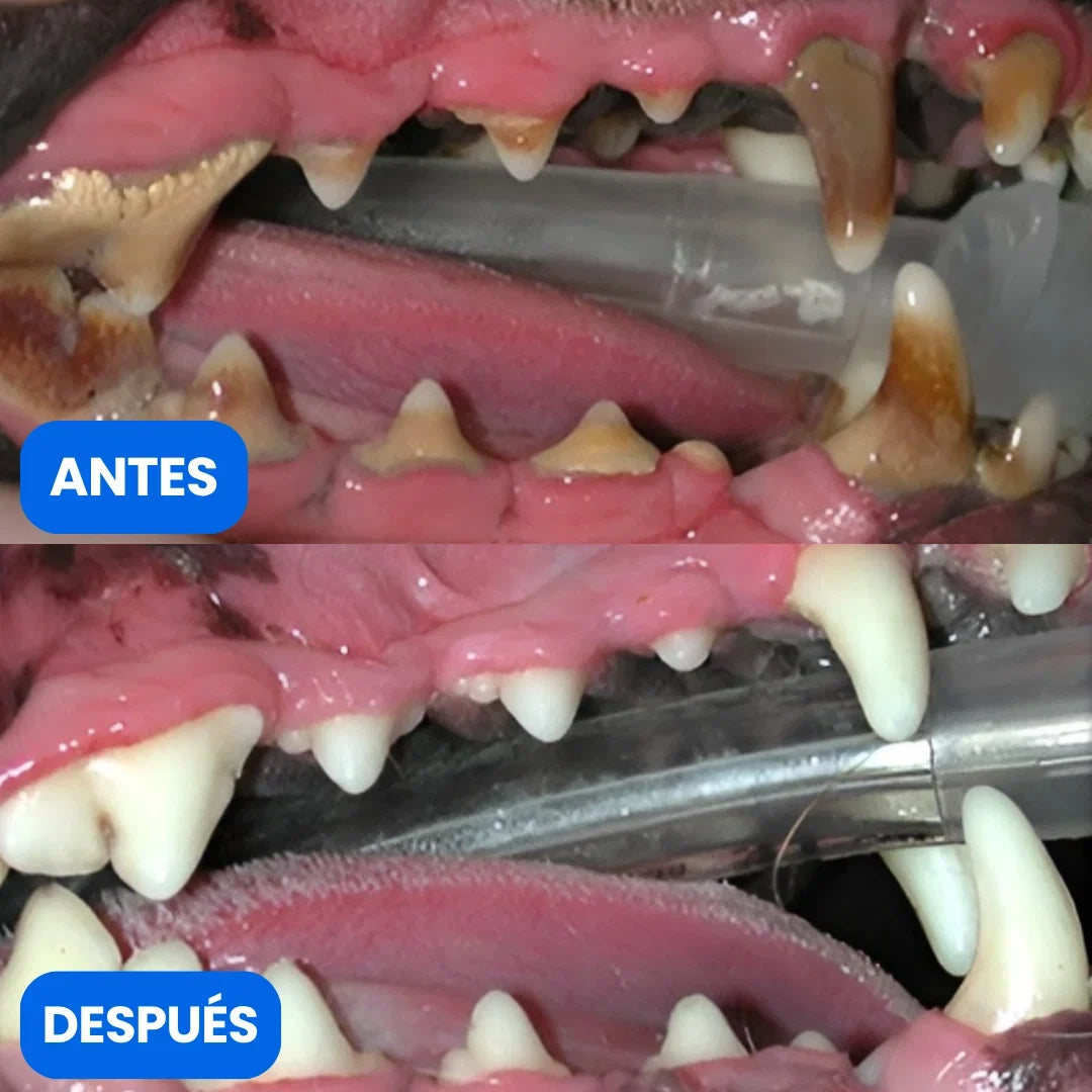 Mordedor Dental 2 en 1